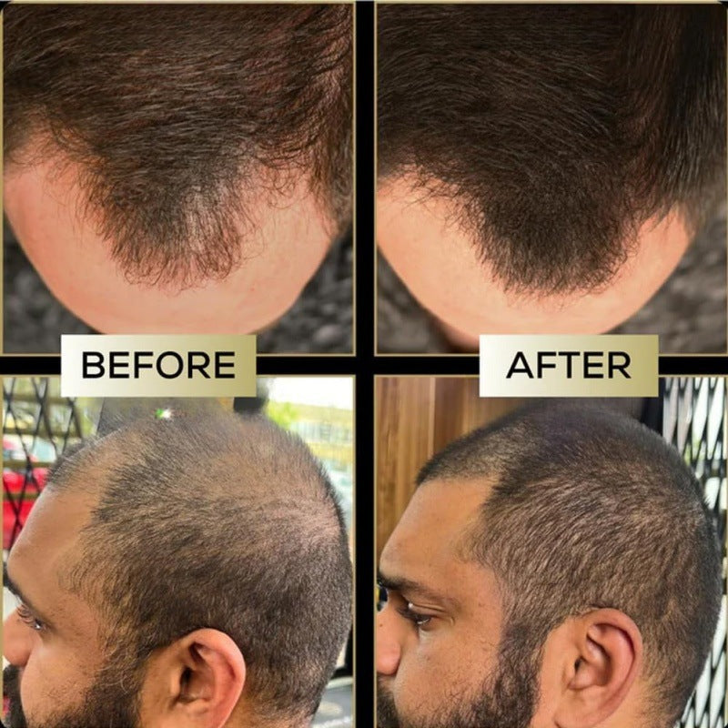 Corector pentru scalp, pentru păr mai gros și natural