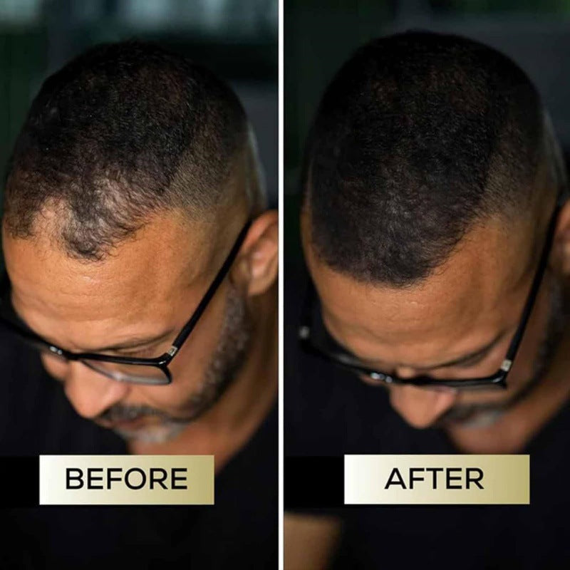 Corector pentru scalp, pentru păr mai gros și natural